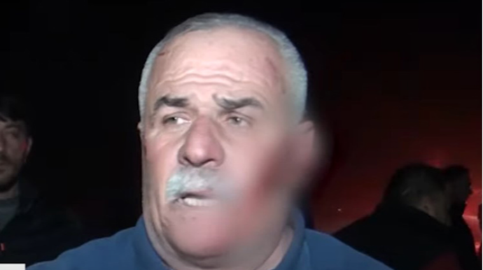 “Gördüm ki, “KamAZ”lar gəlib üstümə çıxdı” - VİDEO