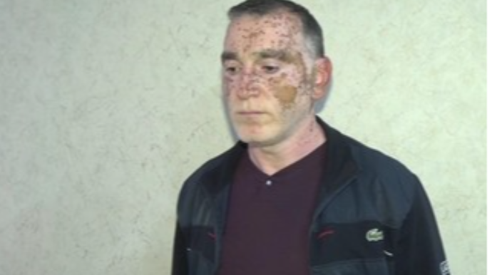 Çətənə yetişdirən qohumlar SAXLANILDI   - FOTO