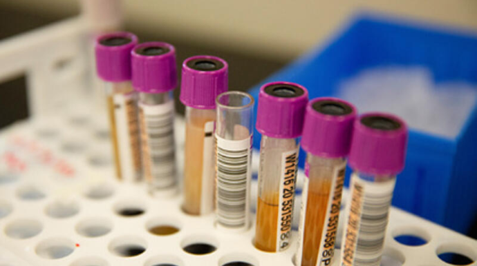 Peyvənddən neçə gün sonra antikor səviyyəsi düşür?