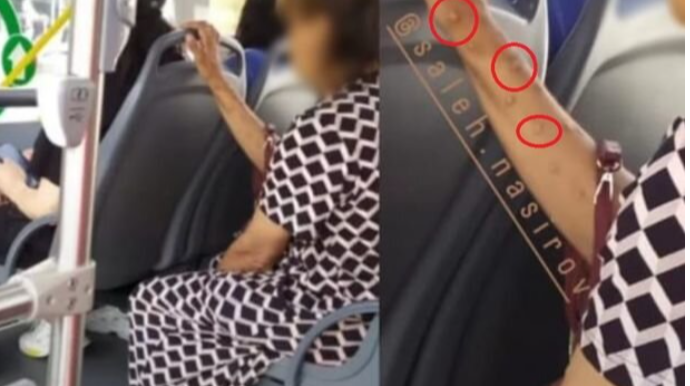 Meymunçiçəyi ilə bağlı şaiyələrə RƏSMİ REAKSİYA  - FOTO