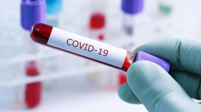 75 futbolçuda koronavirus aşkarlandı