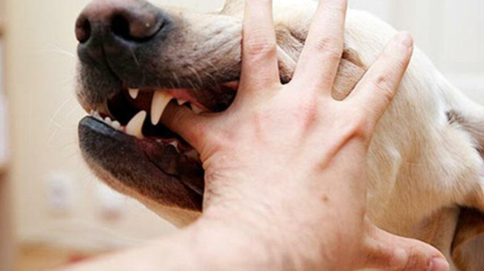 Gədəbəy sakini küçə itlərinin hücumuna məruz qalıb