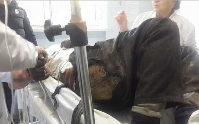 Üzərinə benzin töküb özünü yandırdı