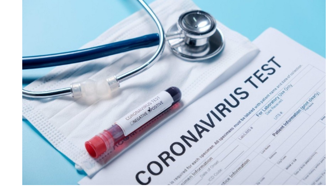 Azərbaycanda daha 2597 nəfər koronavirusa yoluxub