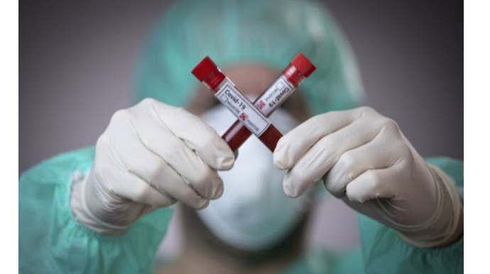 Azərbaycanda indiyədək 2163064 koronavirus testi aparılıb