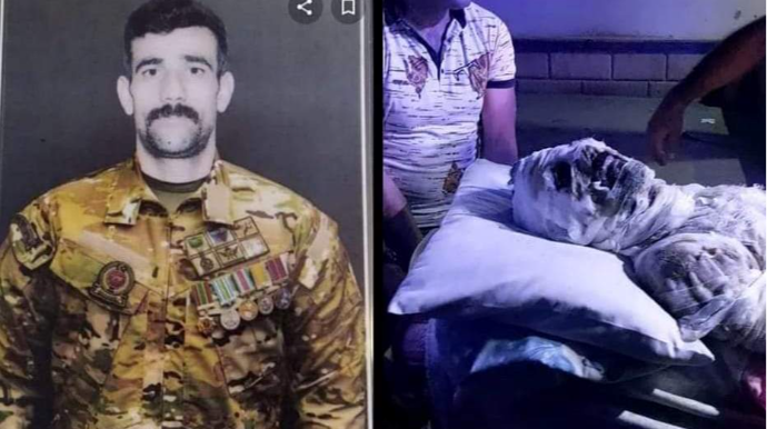 Özünü yandıran qazi VƏFAT ETDİ 