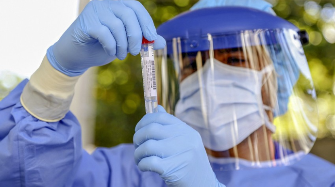 Son sutkada Azərbaycanda 81 nəfər koronavirusa yoluxub 