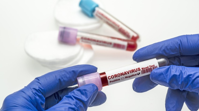 DTX-nin əməkdaşında koronavirus aşkarlanıb