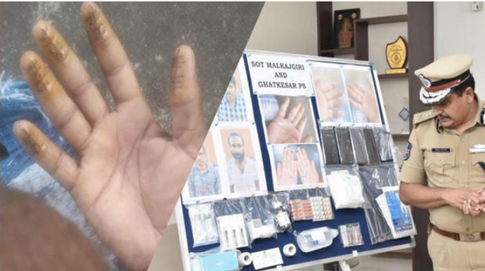 Hindistanda yenidən viza ala bilmək üçün barmaq izlərini dəyişdirdilər  - FOTO