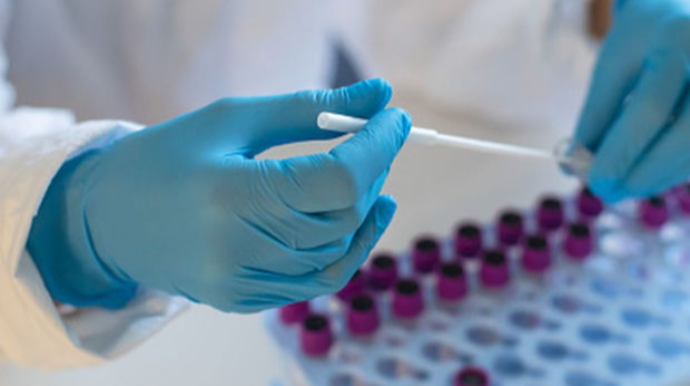 COVID-19-un yeni ştammı daha bir pandemiya dalğasına səbəb ola bilər - ÜST-dən XƏBƏRDARLIQ 