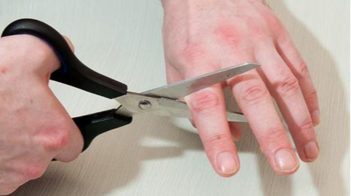 Barmağını kəsib polisə "qohumlarım kəsdi" deyib - XIZADA ŞOK HADİSƏ   - FOTO