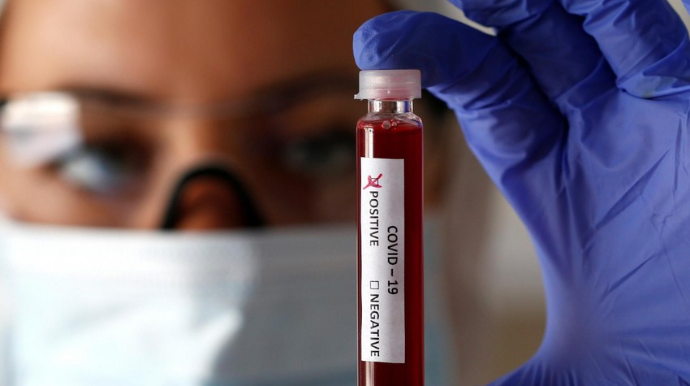 Koronavirusa bu günə olan yoluxma sayı bəlli oldu