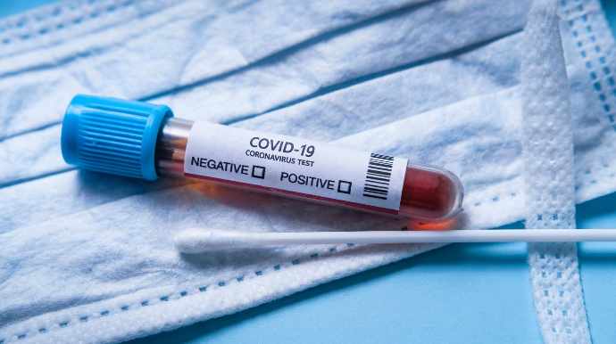 Azərbaycanda 526 nəfər koronavirusa yoluxub, 502 nəfər müalicə olunaraq sağalıb  - VİDEO