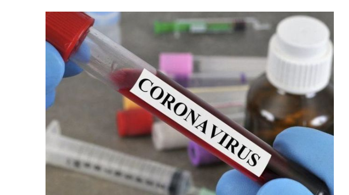 Число инфицированных коронавирусом в мире превысило 43 млн