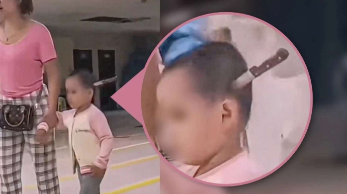 Azyaşlının başından 15 santimetrlik bıçaq çıxarıldı - FOTO