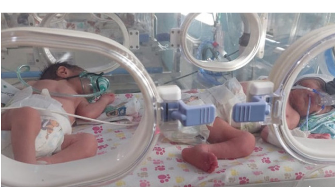 Yeni ilin ilk körpələri əkiz doğuldu - VİDEO