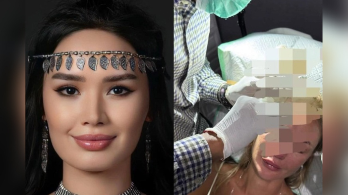 Model bloqerin başına stəkan çırpdı 