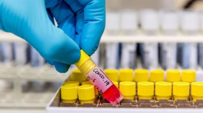 Koronavirusla bağlı SON STATİSTİKA 