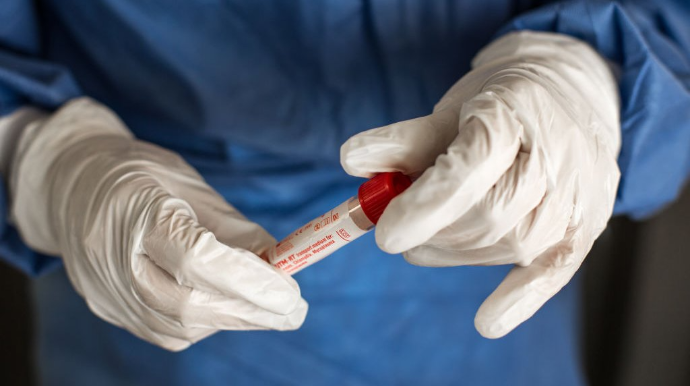 Yeni yoluxucu COVID-in əsas əlaməti AÇIQLANDI 