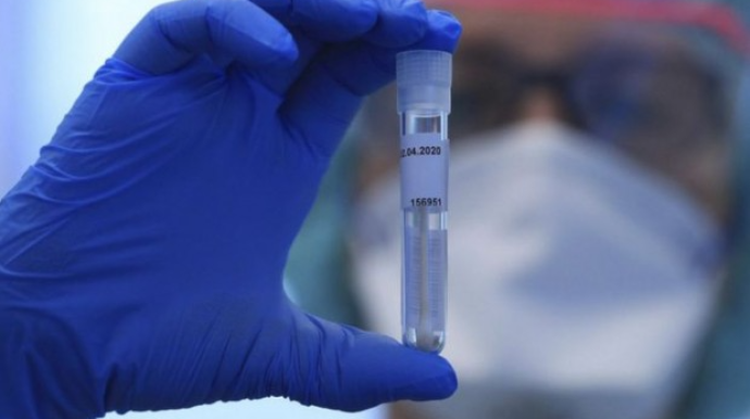 Azərbaycanda koronavirusa yoluxanların sayı yenidən artdı - 2 nəfər öldü 