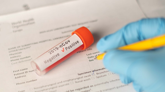 Azərbaycanda son sutkada 182 nəfər COVID-19-a yoluxub, 2 nəfər vəfat edib 