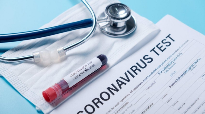 В Азербайджане 162 новых случая заражения коронавирусом