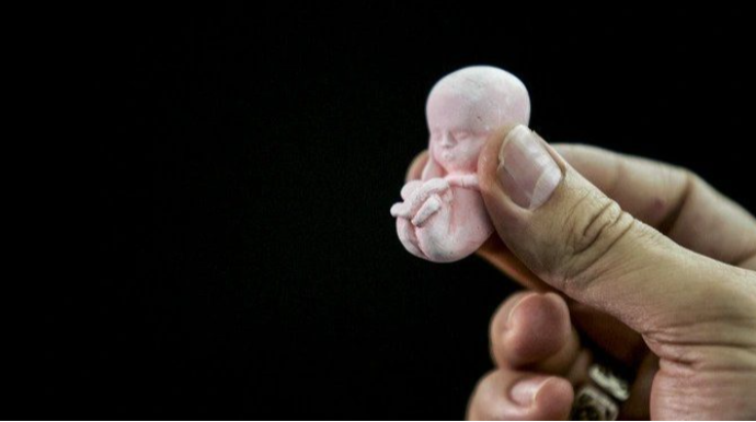 Qanunsuz aborta görə cəzalar SƏRTLƏŞDİRİLİR 