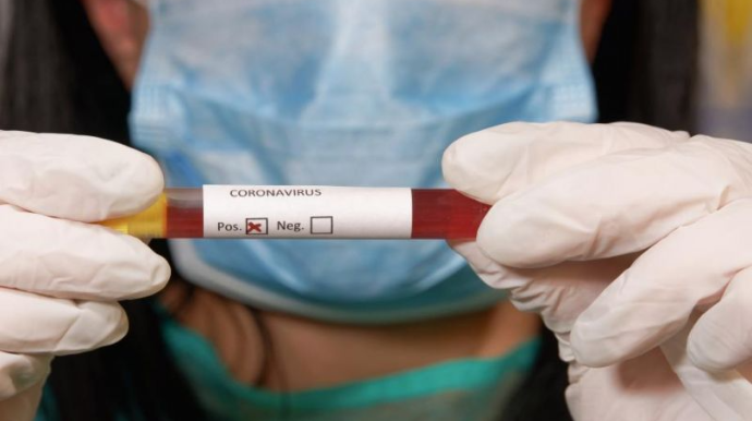 Azərbaycanda koronaya yoluxanların sayı 4 mini keçdi  - FOTO