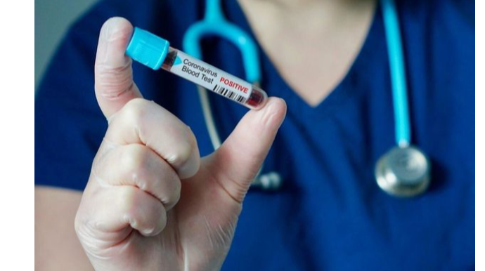 Ev şəraitində müalicə alan COVID-19 xəstəsi növbəti testini harada verməlidir?