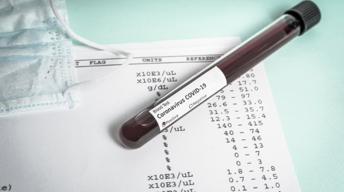 Azərbaycanda daha 75 nəfər COVID-19-a yoluxub, 3 nəfər vəfat edib  - FOTO