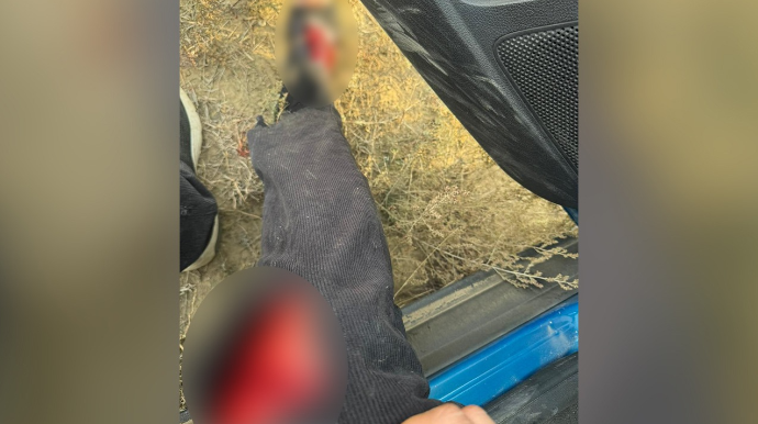 AzTV-nin müxbiri təyyarənin qəzaya düşdüyü ərazidə yaralandı - FOTO