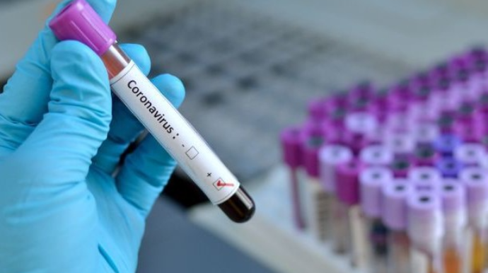 Azərbaycanda son sutkada koronavirusdan iki nəfər ölüb