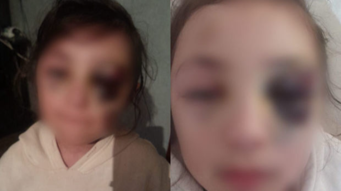 Döyüldüyü iddia edilən məktəblinin anası bəzi məqamlara aydınlıq gətirdi - VİDEO