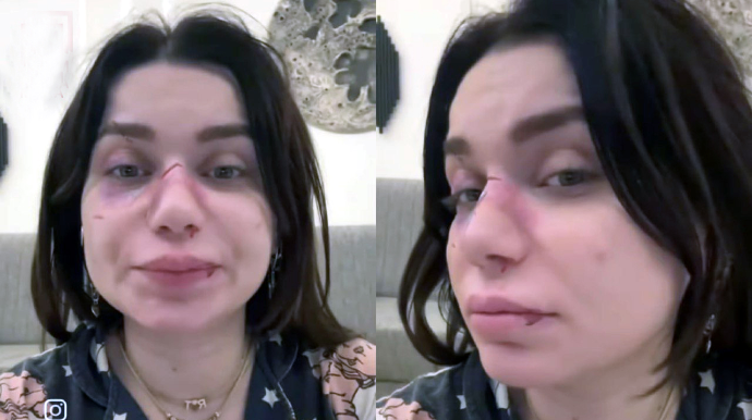 Qadının döyülməsi ilə bağlı görüntülər saxta imiş... – DETALLAR – VİDEO