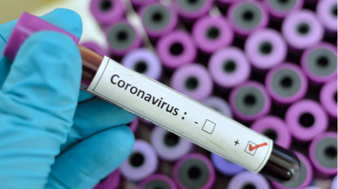 Azərbaycanda son sutkada 26 nəfər koronavirusa yoluxub
