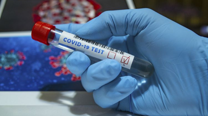 Azərbaycanda indiyədək 868348 koronavirus testi aparılıb