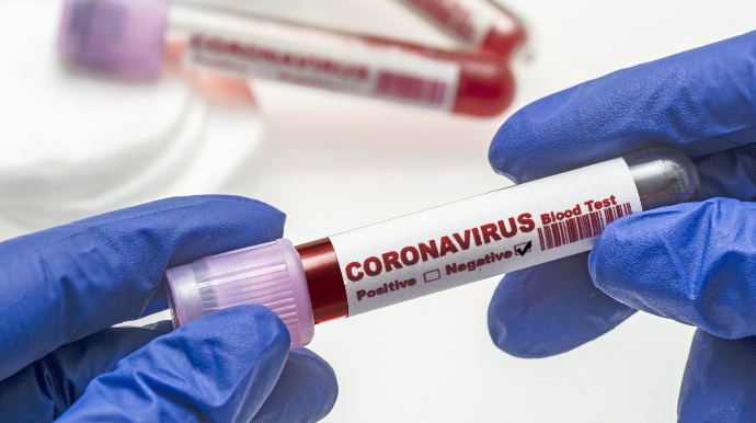 Koronavirus testlərinin maya dəyəri açıqlanıb