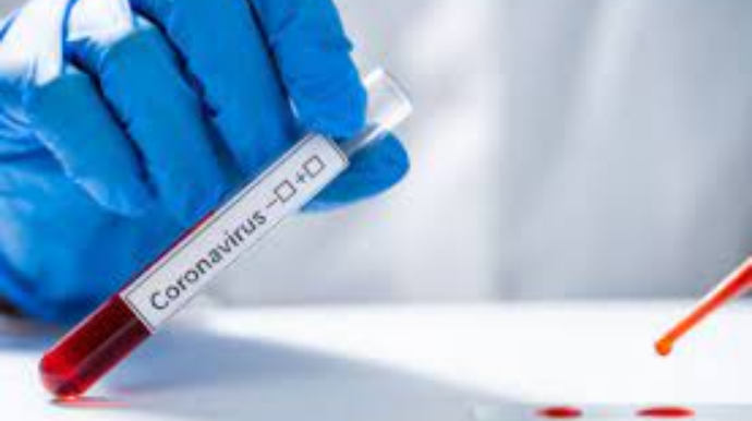 Azərbaycanda son sutkada 144 nəfər koronavirusa yoluxub, 8 nəfər ölüb 