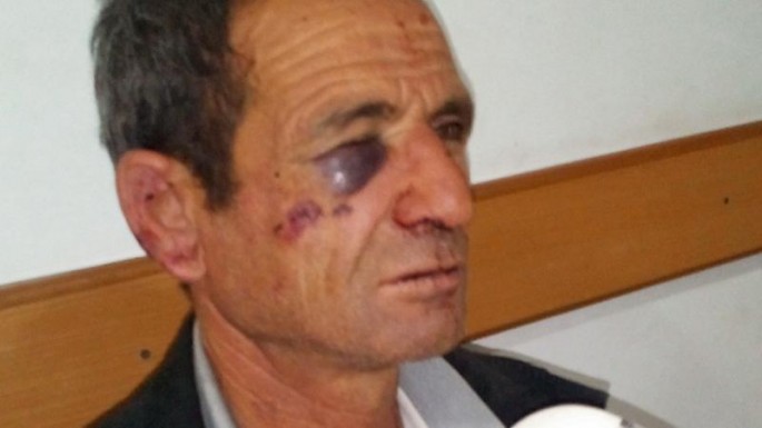 Şamaxıda kütləvi dava: ər-arvad döyüldü - FOTO