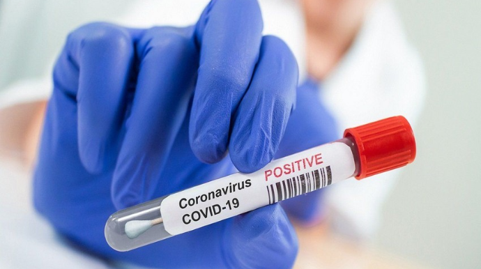 ÜST pandemiya ilə bağlı son statistikanı açıqladı