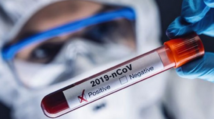 Azərbaycanda koronavirusa yoluxanların sayı AÇIQLANDI 