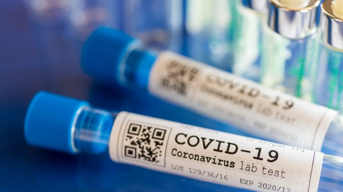 Son sutkada Azərbaycanda 16 nəfər koronavirusa yoluxub, 3 nəfər ölüb 