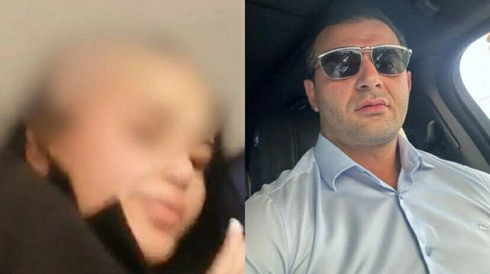 Arvadının saçını keçəl edən ər - Həbs olundu 