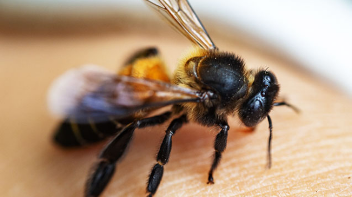 Qonaq getdiyi evdə arı sancdı, öldü