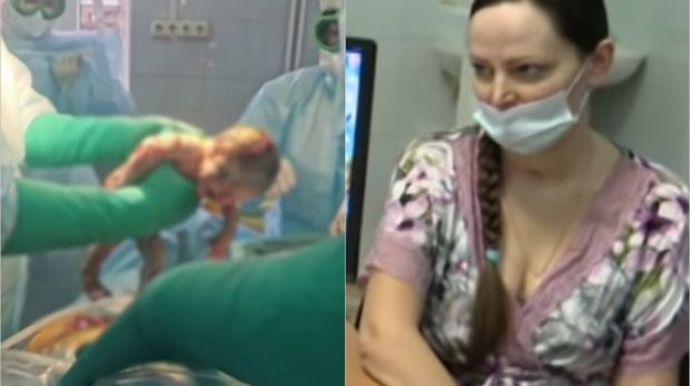 В России врачи спасли беременную с коронавирусом при полном поражении легких  - ВИДЕО