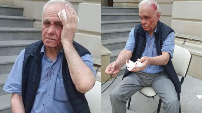 Rəhim Qazıyevə xəsarət yetirən şəxsin kimliyi bəlli oldu   - FOTO