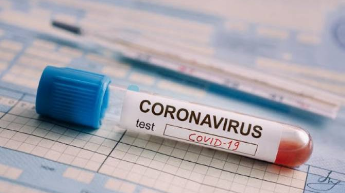 Ermənistanda uşaq evində koronavirus aşkarlanıb