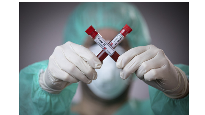 Son sutkada 570 nəfər COVID-19-a yoluxub, 19 nəfər vəfat edib   - FOTO