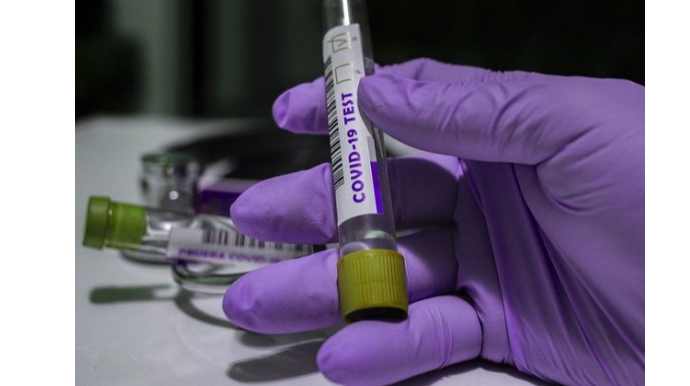 Azərbaycanda koronavirusdan rekord ölüm qeydə alındı  - FOTO