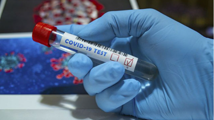 Azərbaycanda daha 601 nəfər COVID-19-a yoluxub, ölən olmayıb 